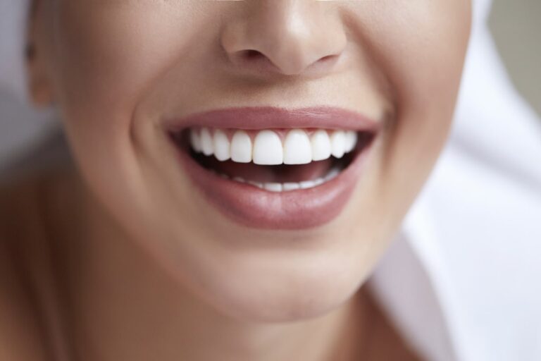 scatto-del-sorriso-di-un-paziente-dopo-l-applicazione-delle-faccette-dentali
